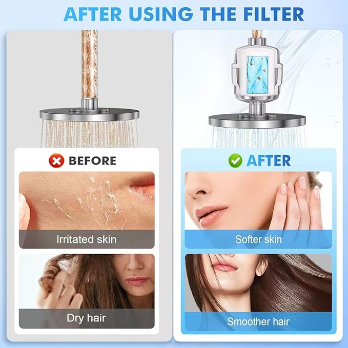 20 Stage Shower Filter, Universal Hard Water Filter Removes Chlorine & Impurities, High Flow Chrome Shower Head Filter Water Softener for Dry Skin, Hair Loss and Sensitive Skin