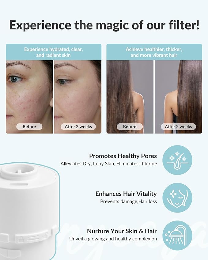 SANYCASA Shower Filter for SANYCASA Beauty Shower Head, KDF-55 Filter Dermatologist Recommended for Softening Hard Water, Improves Hair & Skin 2 Pack