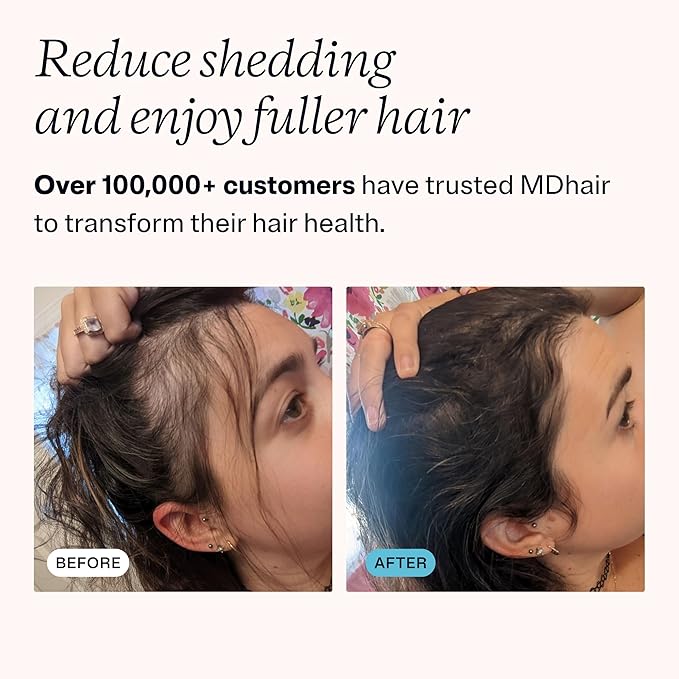 MDhair Mounted & Handheld Filtered Showerhead Bundle for Healthier Hair & Skin - Multi-Stage Filter Removes Chlorine & Heavy Metals, Dermatologist-Formulated Shower Head Filter for Hard Water