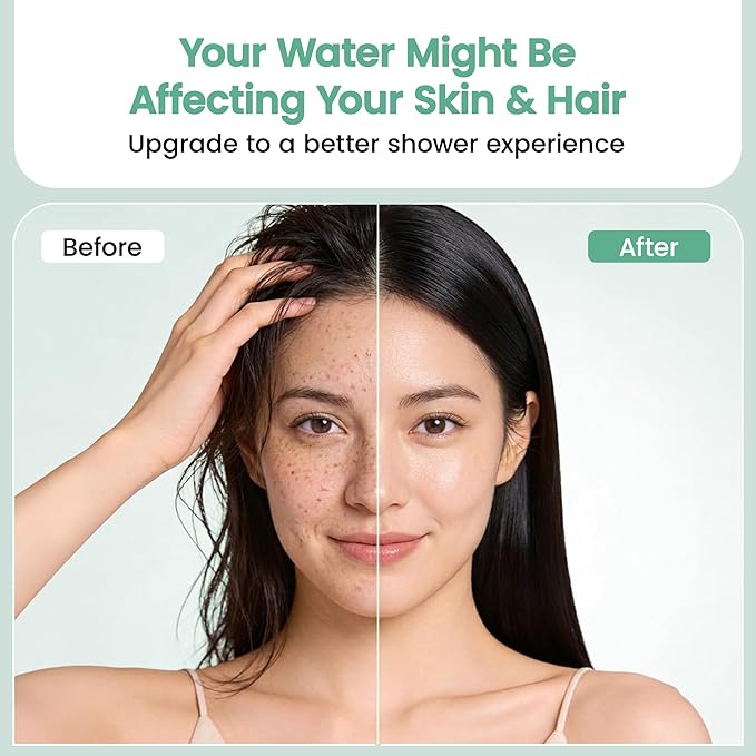 High Pressure Filtered Shower Head for Hard Water| Chrome Shower Filter for Hair & Skin | Calcium sulfite, Activated Carbon & KDF-55 | Easy Install with Easy Swap Filter Replacement