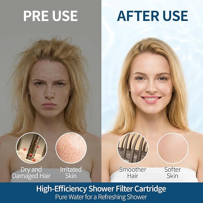 Shower Filter Only for SR SUN RISE Handheld Shower Head, 2-Pack Replacement Filters for Hard Water, NSF Certified 99% Chlorine Removal - Reduces Dry Itchy Skin