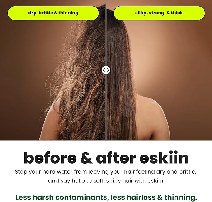 Eskiin Shower Head Water Filter Replacement For The Eskiin Showerhead - High Pressure Shower Heads Replacement For Smooth Hair & Skin - Replacement Cartridge Fits The Eskiin Filtered Shower Head